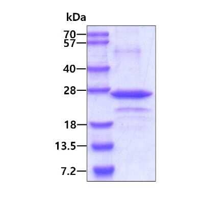 SDS-PAGE: Recombinant Human COPS8 His Protein [NBP1-72515]